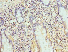 PSMB10 Antibody