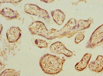 PSMB3 Antibody