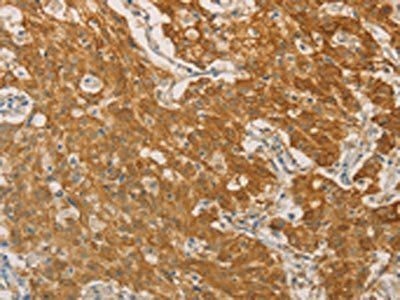PSMB7 Antibody