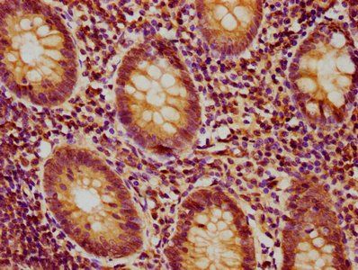 PSMB9 Antibody