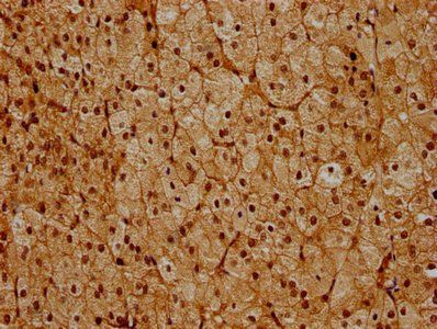 PSMC6 Antibody