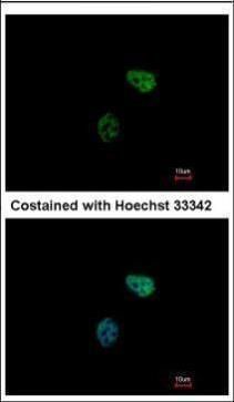 PSMC6 antibody