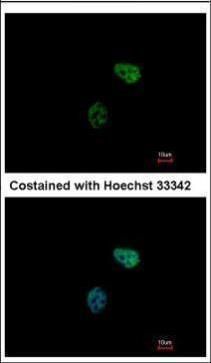 proteasome 26S subunit, ATPase 6 Antibody