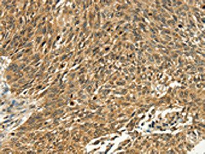 PSMD10 antibody