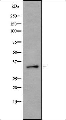 PSMD14 antibody