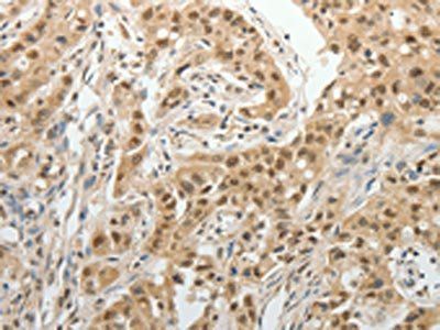 PSMD14 Antibody