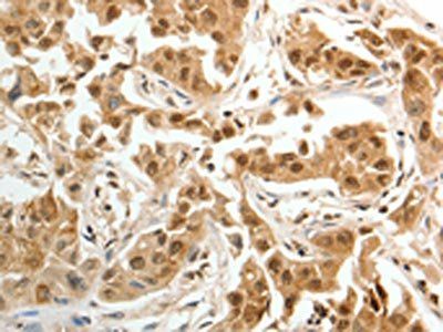 PSMD14 Antibody