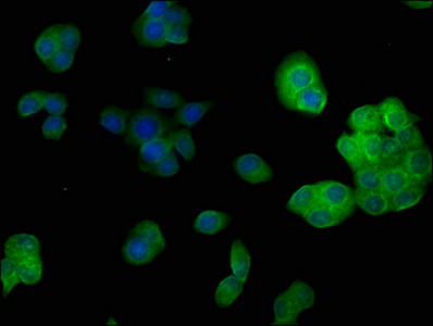 PSMD14 antibody