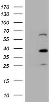 PSMD2 antibody