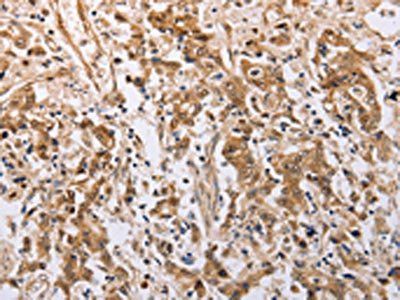 PSMD3 Antibody