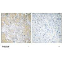 PSMD3 Antibody