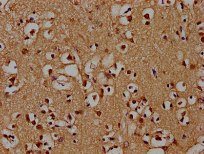 PSMD4 Antibody