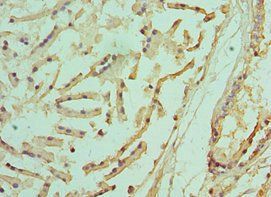 PSMD5 Antibody
