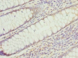 PSMD8 Antibody