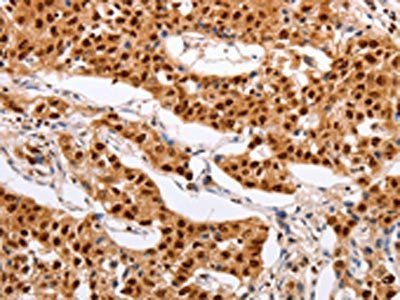 PSMD8 Antibody
