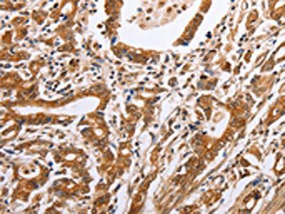 PSMD8 Antibody