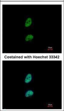 proteasome activator subunit 3 Antibody