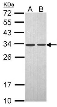 PSME3 antibody