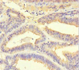 PSMF1 antibody