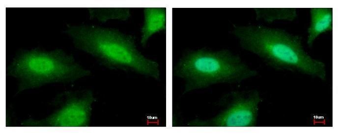 PSMF1 antibody [C2C3], C-term