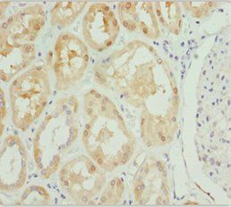 PSPH Antibody