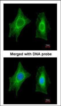PSPH Rabbit Polyclonal Antibody