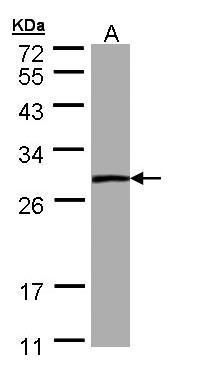 PSPH Rabbit Polyclonal Antibody