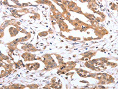 PSPN Antibody