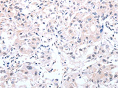 PSPN Antibody