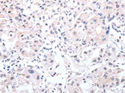 PSPN antibody