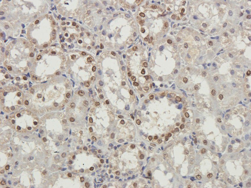 PTCH1 antibody