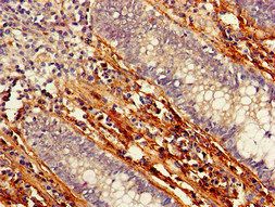 PTCH1 Antibody