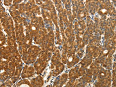 PTCH1 Antibody