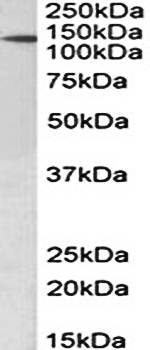 PTCH1 antibody