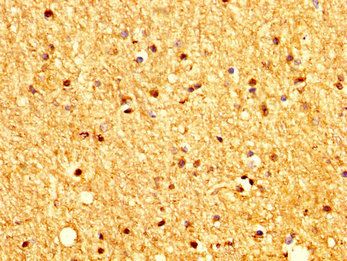 PTCH2 Antibody