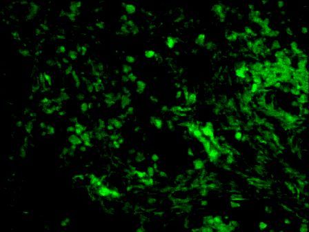 PTCH antibody (FITC)