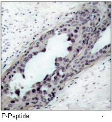 PTEN (Phospho-Ser380/Thr382/Thr383) Antibody