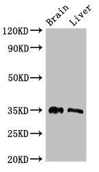 PTF1A Antibody