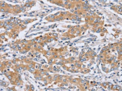 PTGER2 Antibody
