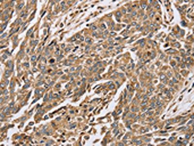 PTGER2 Antibody