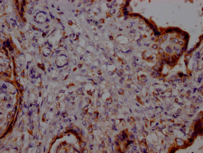 PTGER2 Recombinant Monoclonal Antibody