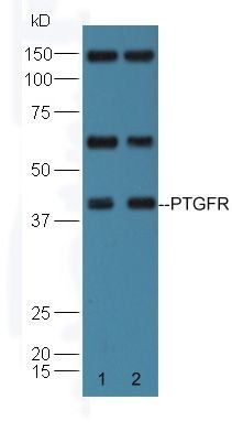 PTGFR antibody