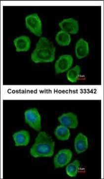 PTGFRN antibody