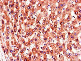 PTGR1 Antibody
