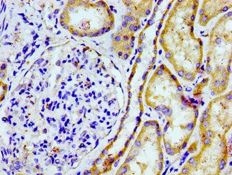 PTGR2 Antibody