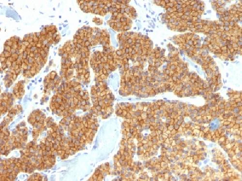 Parathyroid Hormone (PTH) (N-Terminal) Antibody
