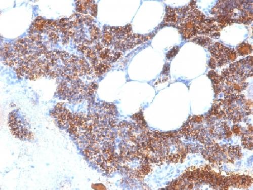 Parathyroid Hormone (PTH) (N-Terminal) Antibody