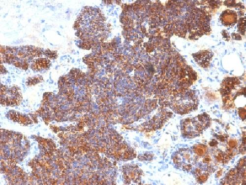 PTH Antibody