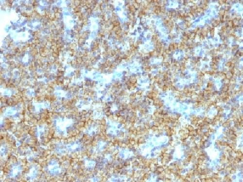 PTH Antibody
