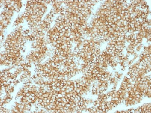 Recombinant Parathyroid Hormone (PTH) (N-Terminal) Antibody